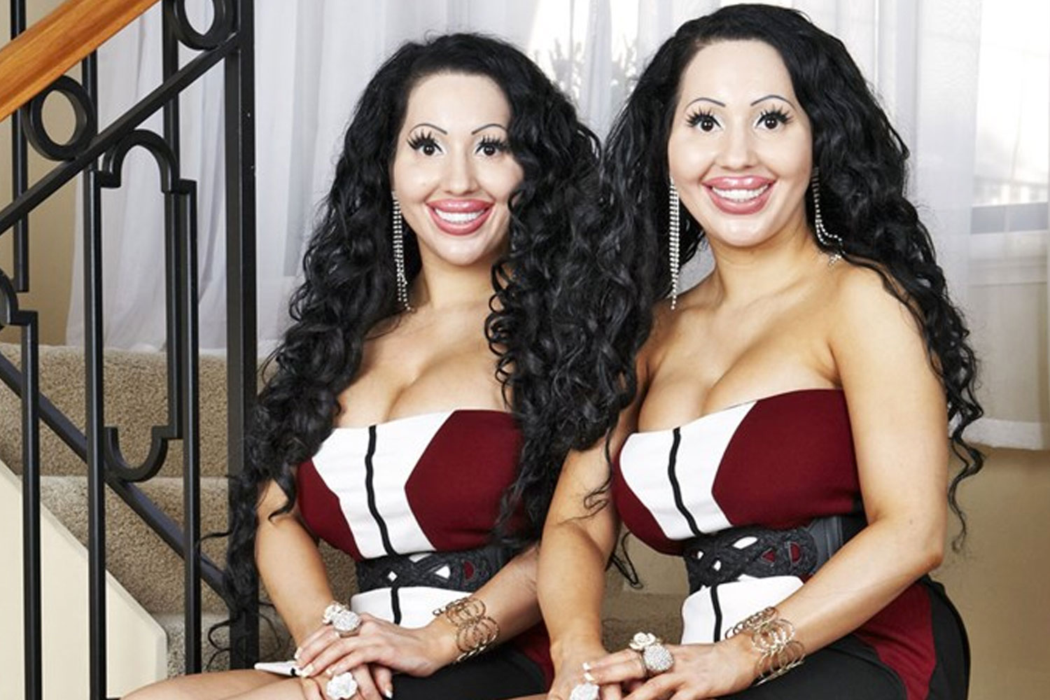 Identical twins Anna and Lucy Decinque reverse plastic surgery.