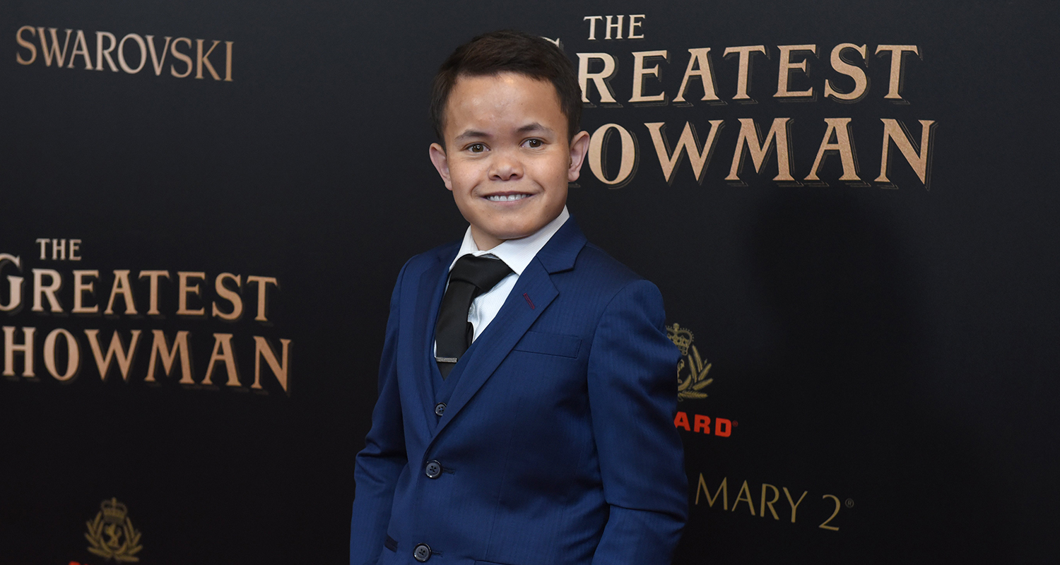 The Greatest Showman Sam Humphrey HighRisk Surgery WHO