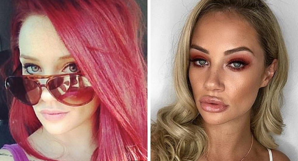 The shocking beforeandafter transformations of Married At First Sight(01)