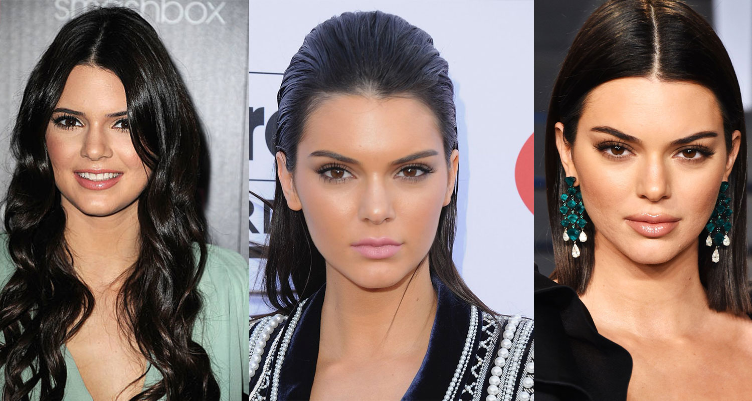 Before and after Kendall Jenner