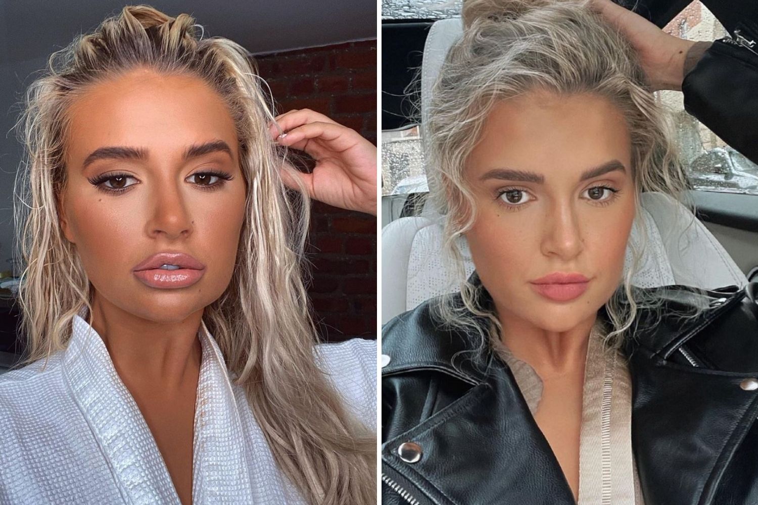molly mae plastic surgery Image 7